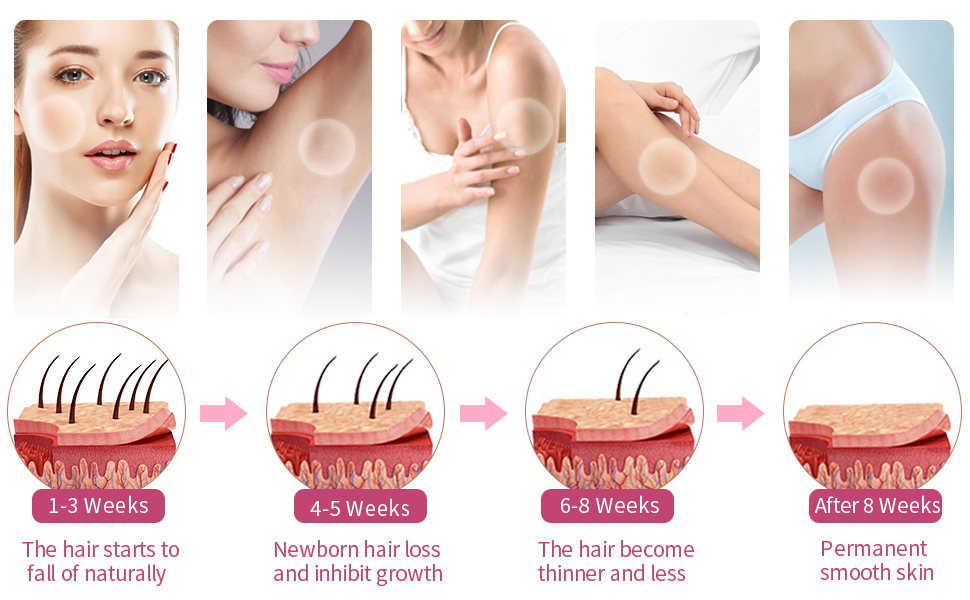 8-12 WEEKS TREATMENTS PERMANENT HAIR REMOVAL