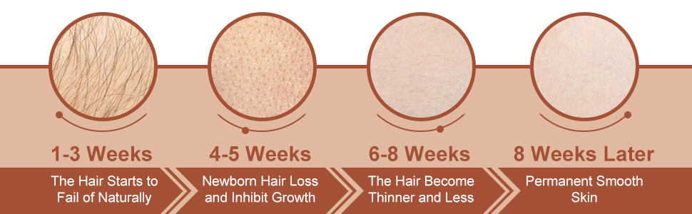 8-12 weeks treatment of ipl laser hair removal